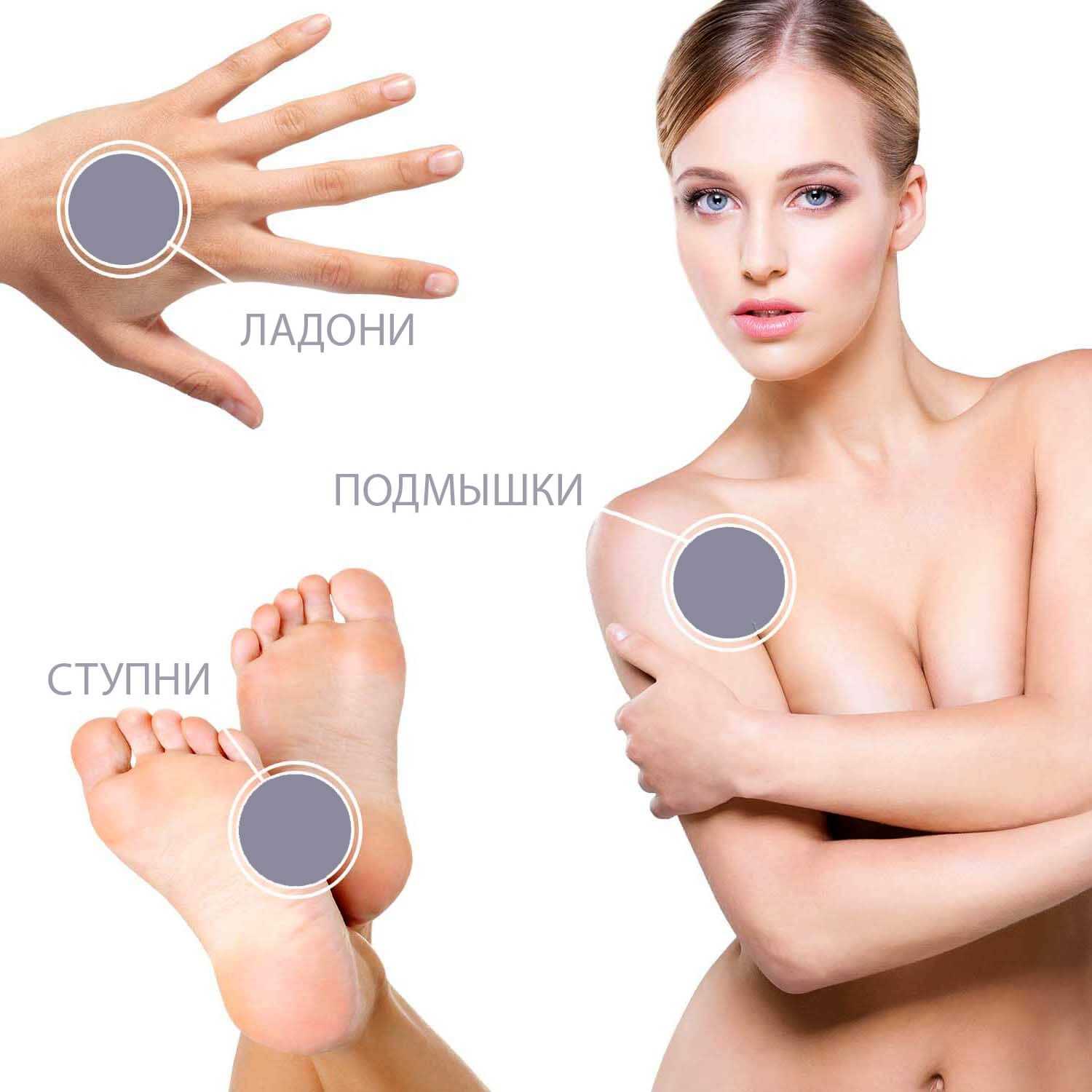 Что такое гипергидроз?